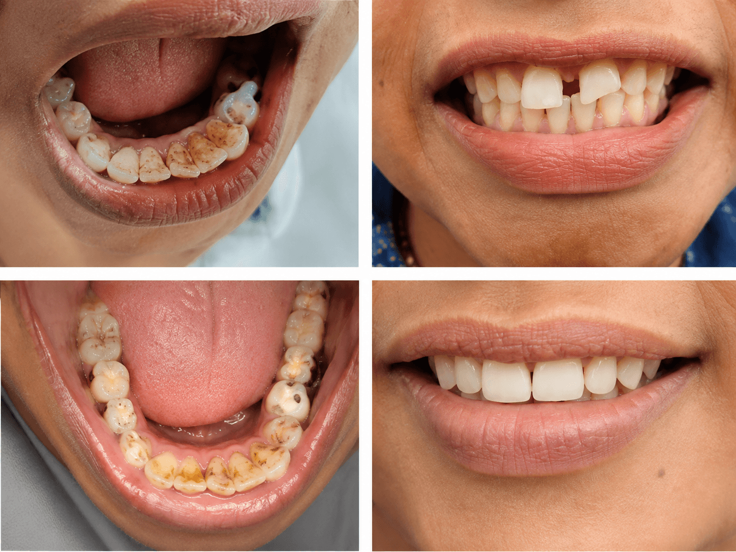 Dental treatment